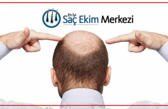 Saç ekimi nasıl yapılır?