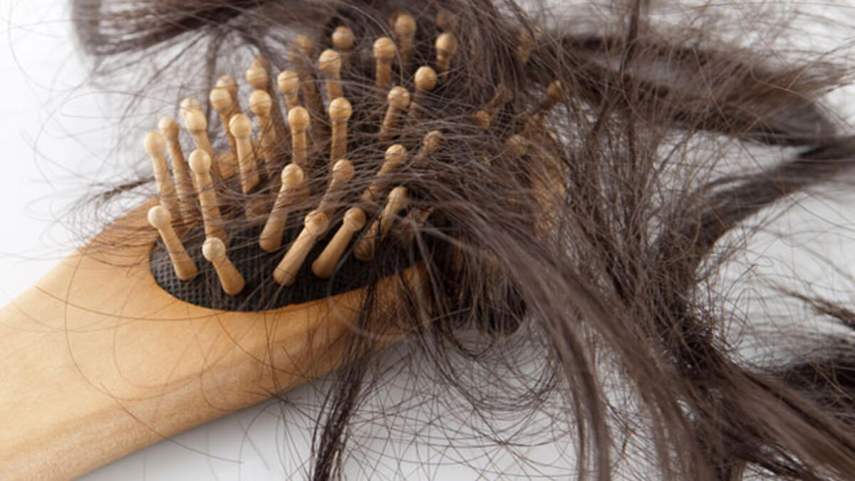 Kadınlarda Aşırı Saç Dökülmesi Neden Olur?