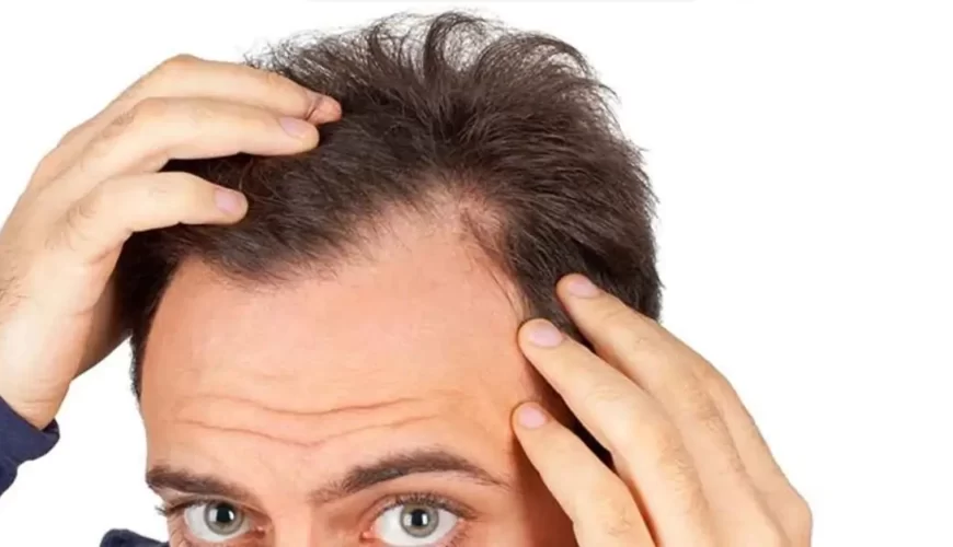 Kırklareli Saç Ekimi Fiyatları