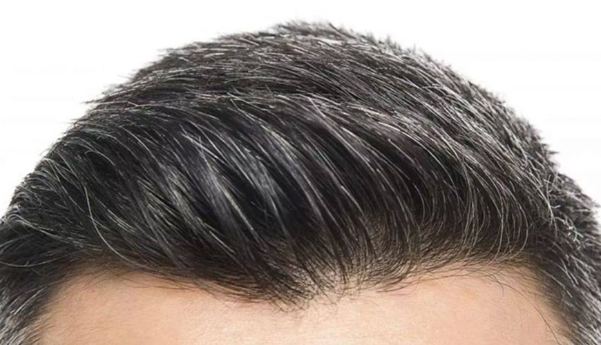 Mersin Saç Ekimi Fiyatları