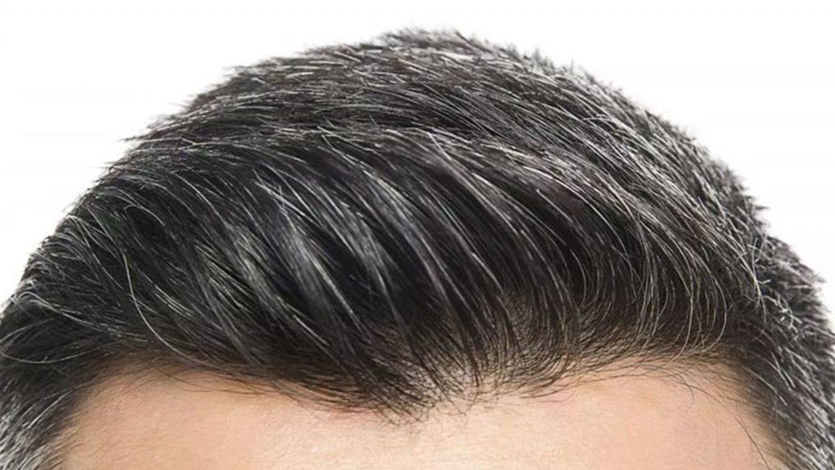 Mersin Saç Ekimi Fiyatları