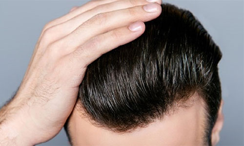 Saç Ekimi İstanbul Avrupa Yakası